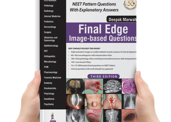 final edge